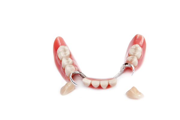 Options For Partial Dentures